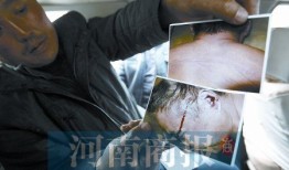 男子酒驾进警局做笔录后死亡尸体脸部有血迹